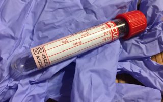 Boli-acute-transmisibile-cu-frecventa-crescuta