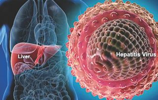 Hepatitele-virale-clinica-medicala-privata-Medo